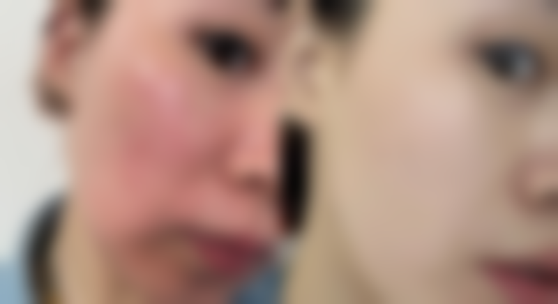 王学亚医生口碑评价