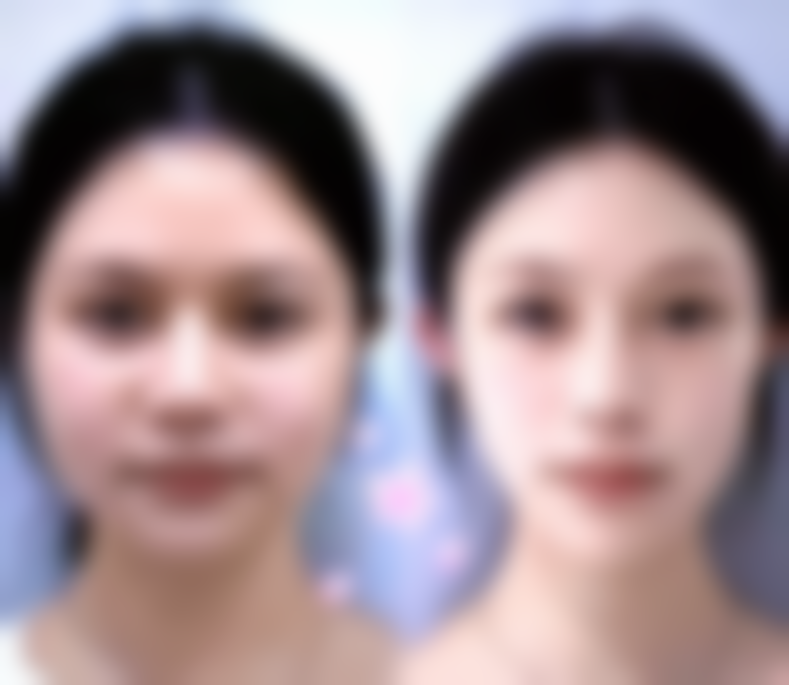 成都安莎贝拉整形医疗美容预约挂号方式