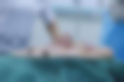 李长富医生的真实实例