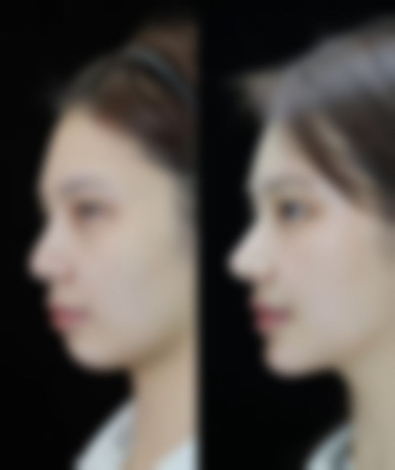 成都美呀皮肤医学整形美容真实实例