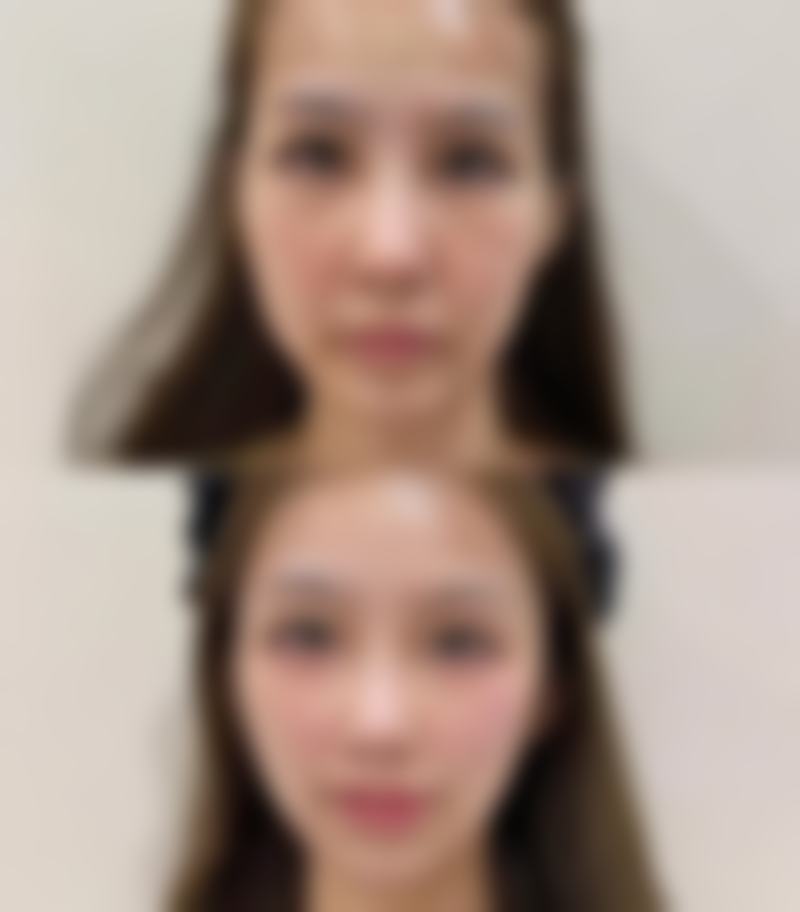 三门峡华美整形真实实例：见证美丽蜕变