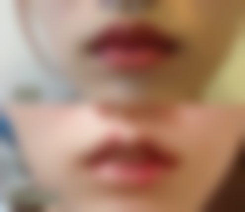 David医生怎么预约挂号：便捷又效率高