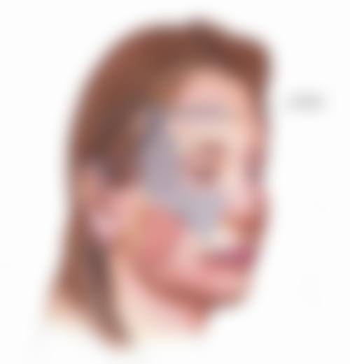 David医生真实实例：见证美丽蜕变