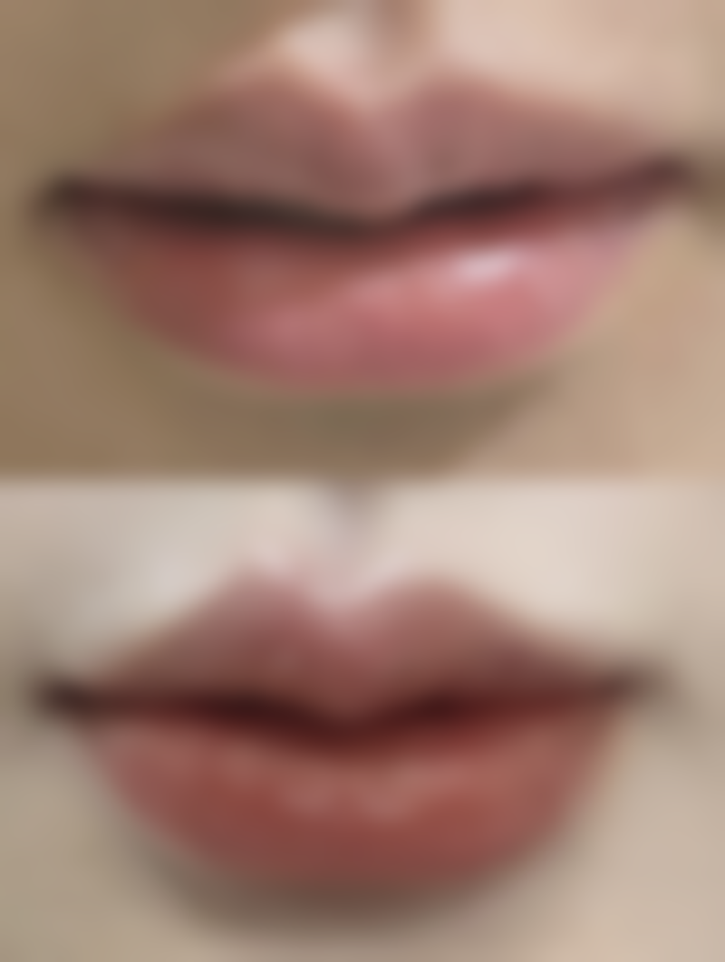 宁波海曙美之术医疗美容诊所擅长项目