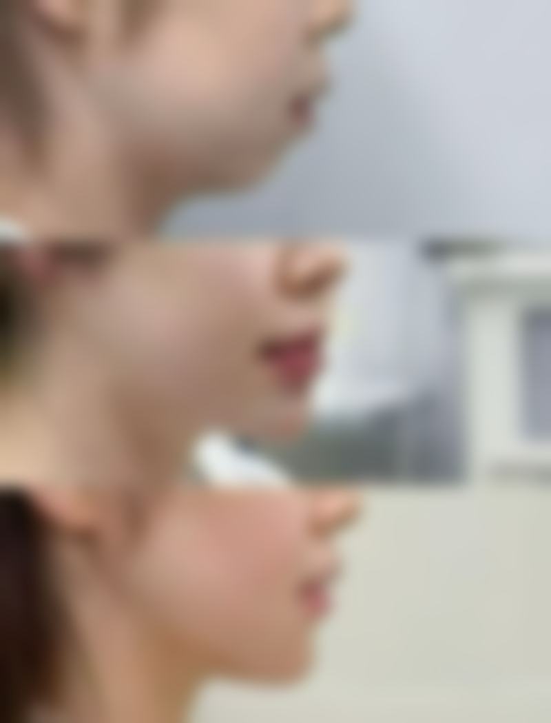 曾碧江医生擅长项目