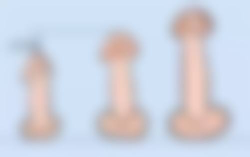 武汉斯启诺医疗美容门诊部王文实例成效受哪些因素影响