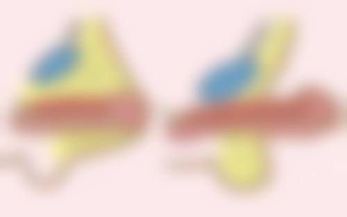 药物治疗烫伤白色疤痕值不值