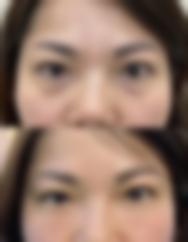 彭冲医生擅长项目：高能型医美骨干医生