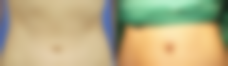 刘余宏医生荣誉资质