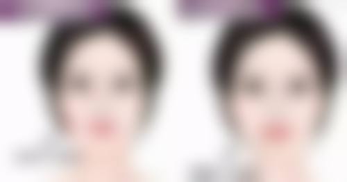 全身抽脂详细流程适合所有人吗