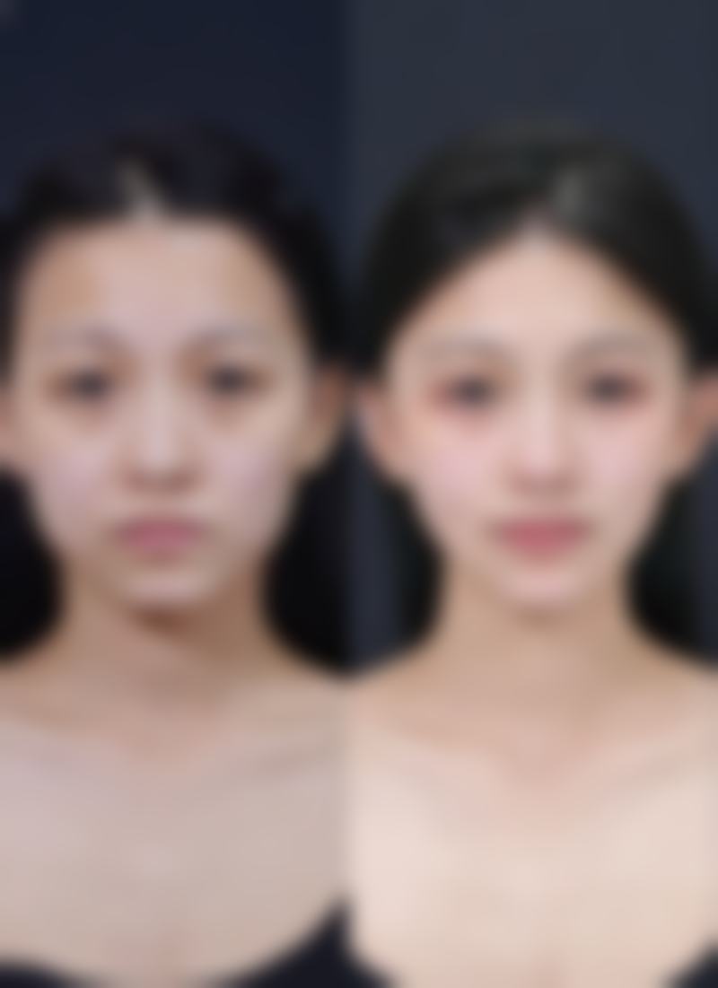 长沙渏蘅医疗美容门诊部真实实例