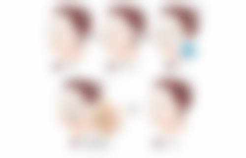 蛋白线提升隆鼻热门材料怎么样