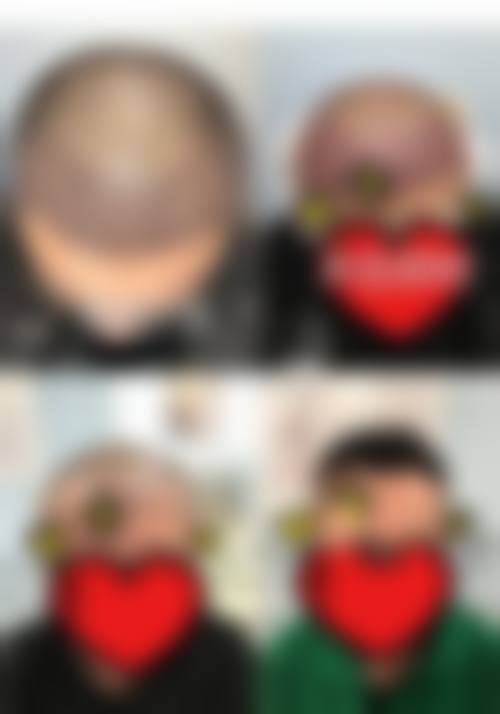 蒙城县第二人民医院整形美容科地址及乘车路线