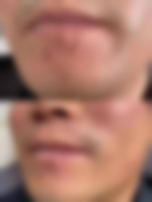 广州唯伊医疗美容门诊真实实例