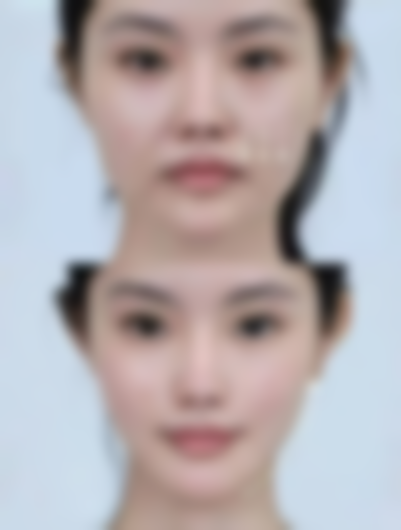 彭冲医生看诊优势