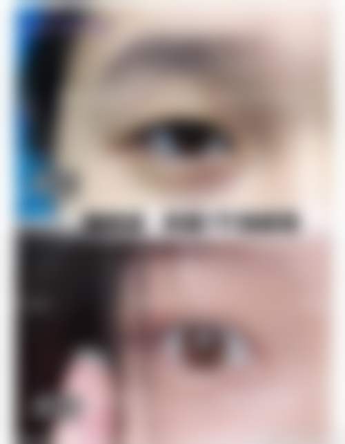 唐卓医生真实实例