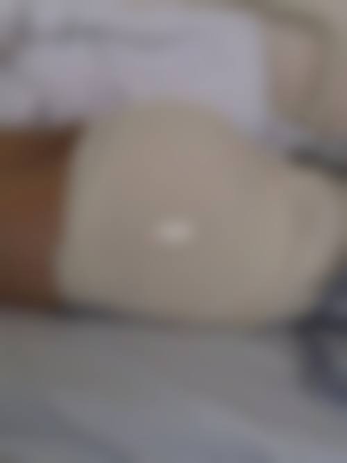 徐州艾优美紫馨整形医院擅长项目