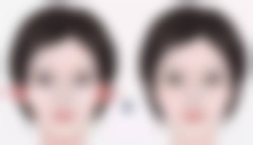 医美汤敏医生技术特点