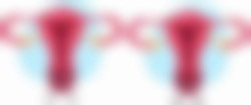 无创双眼皮术后修复时间长吗