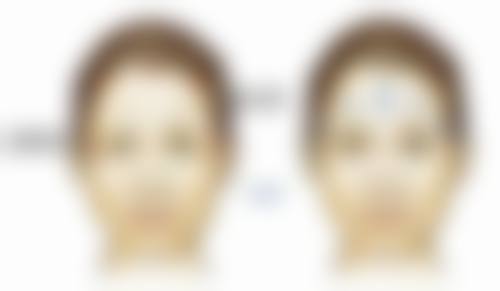 陈琳森医生真实实例