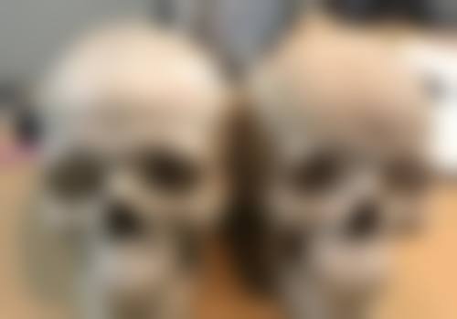 肚子大抽脂后做好护理靠谱吗?