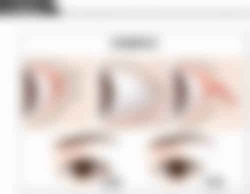 武汉斯启诺医疗美容门诊部刘敏先手术成功几率与其他医生相比如何