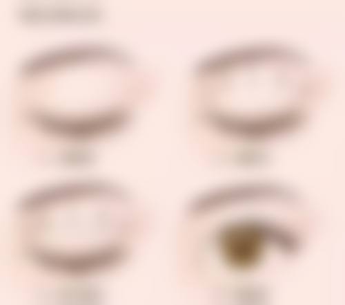 合理操作的假体隆胸靠谱吗