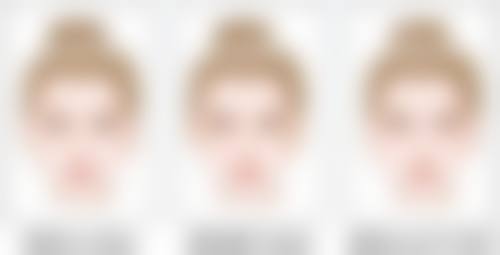 微针治疗加速疤痕黑印消退值不值