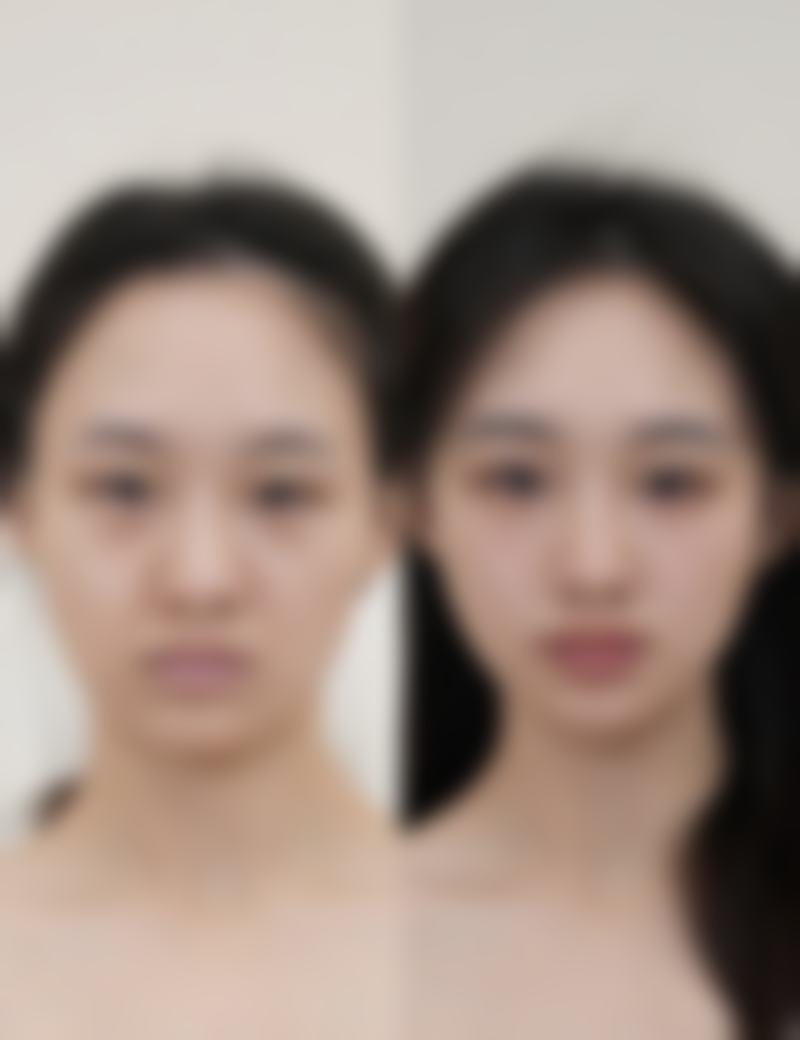 滕召勇医生擅长项目