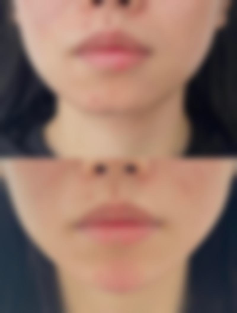 黄朝帅医生技术特点