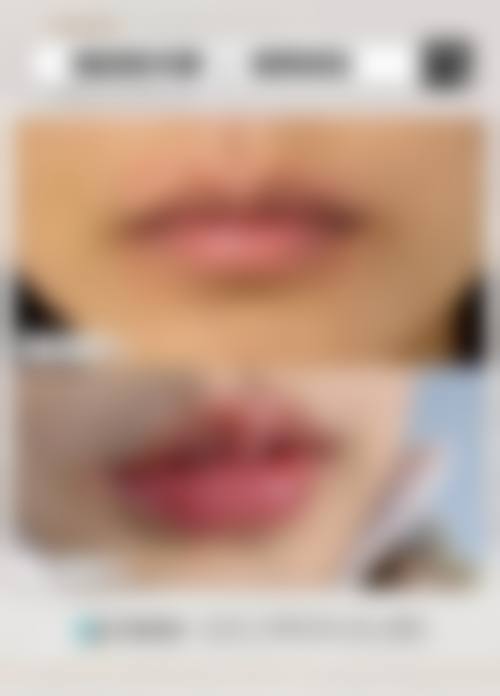 西安迪美医疗美容诊所真实实例