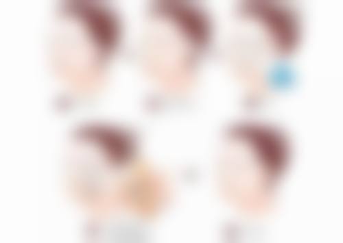不同类型伤口愈合后疤痕发黑情况一样吗