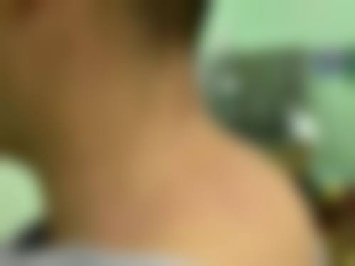 广州景福医疗美容门诊部真实实例