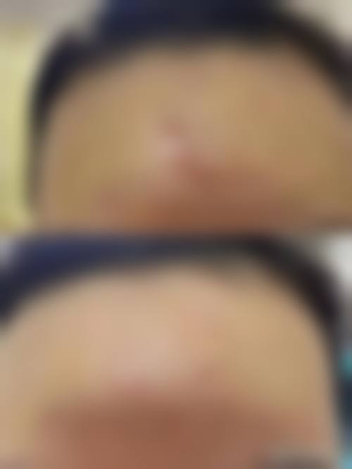 广州景福医疗美容门诊部价格表