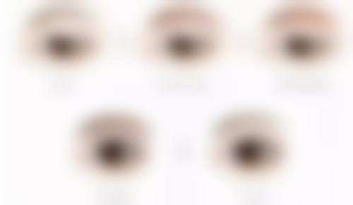 做眼袋手术全麻适合哪些人