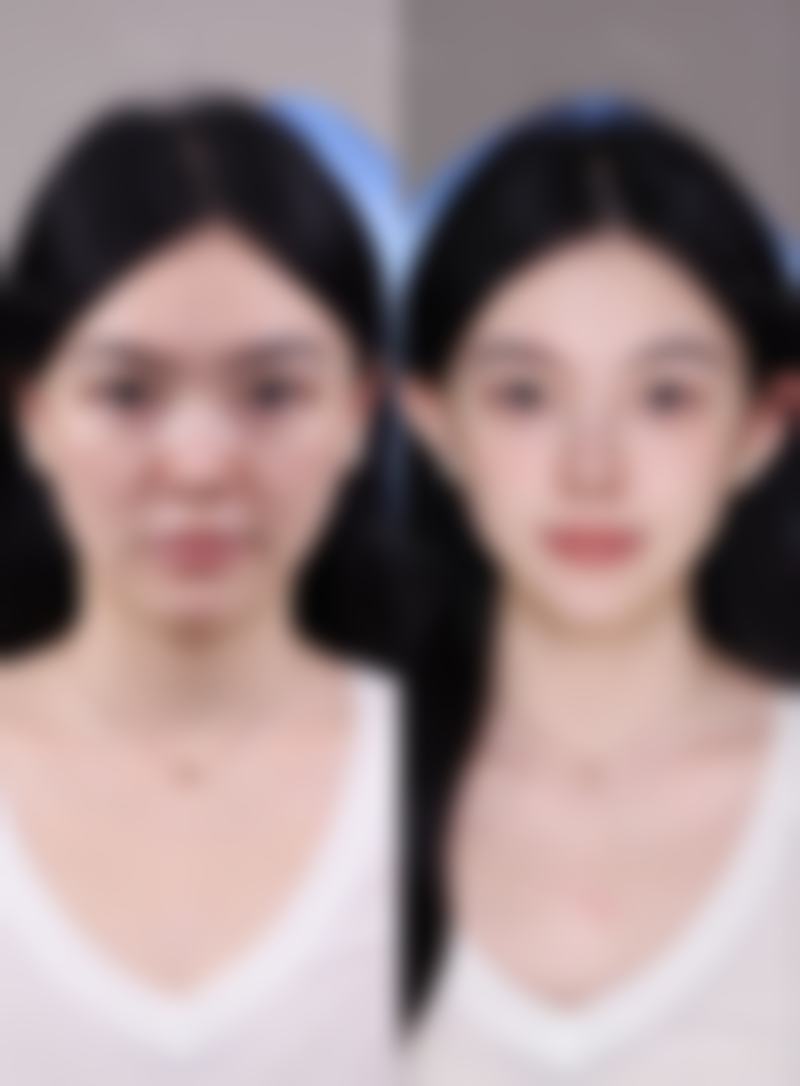 王书勇医生技术特点