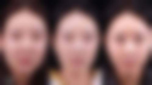 童晓昕医生技术特点：精细微创自然