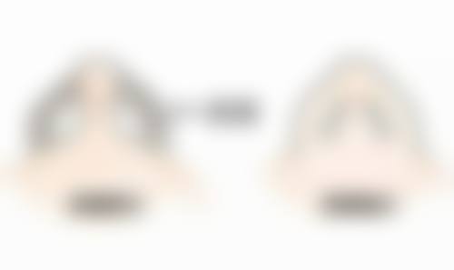 张沃淮医生真实实例