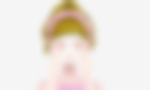 被油烫伤的疤痕去掉后要注意什么
