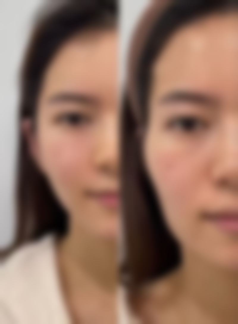 做眼袋术前做好身体检查适合吗?