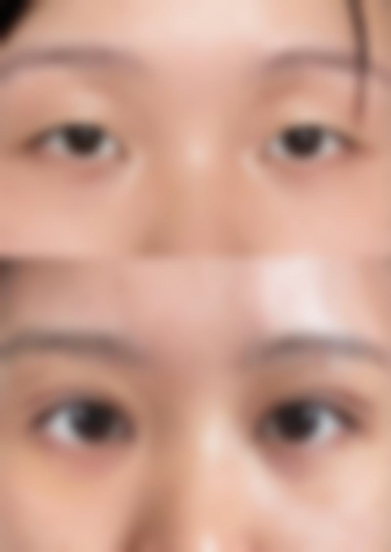 张沃淮医生技术特点