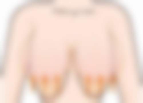 钟一鸣医生真实实例