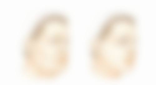 假体隆胸影响生育的概率大吗