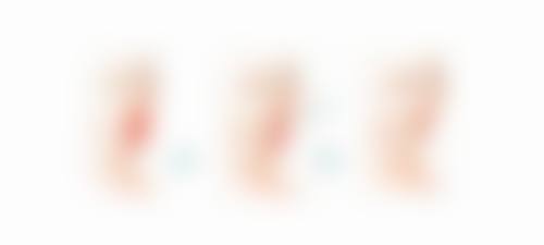 快速去除眼袋淤青值不值去尝试