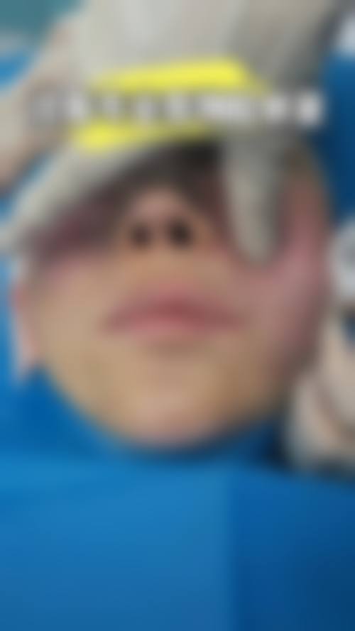 北京汉华医疗美容诊所真实实例