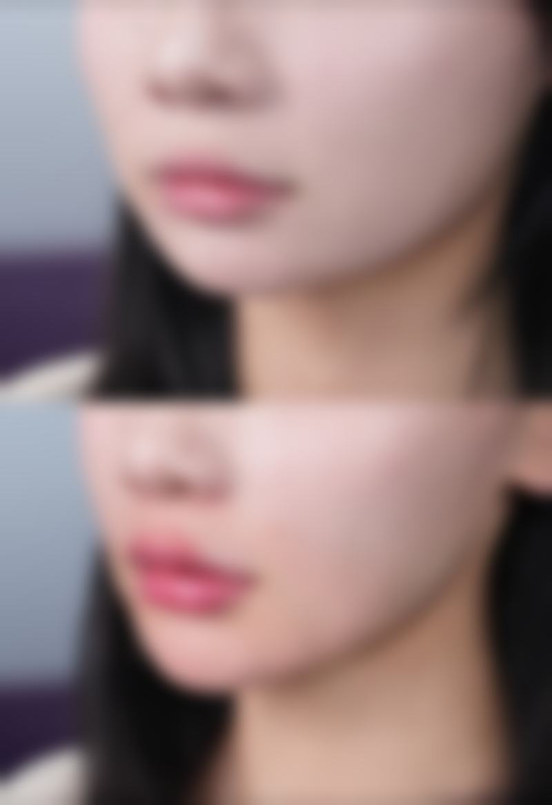 吴美容医生擅长项目