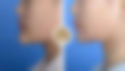许志英医生的技术特点