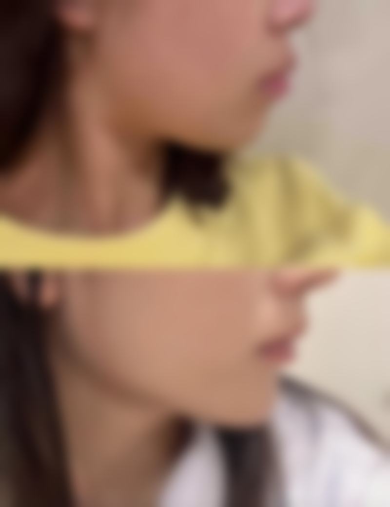 郭明雷医生擅长项目