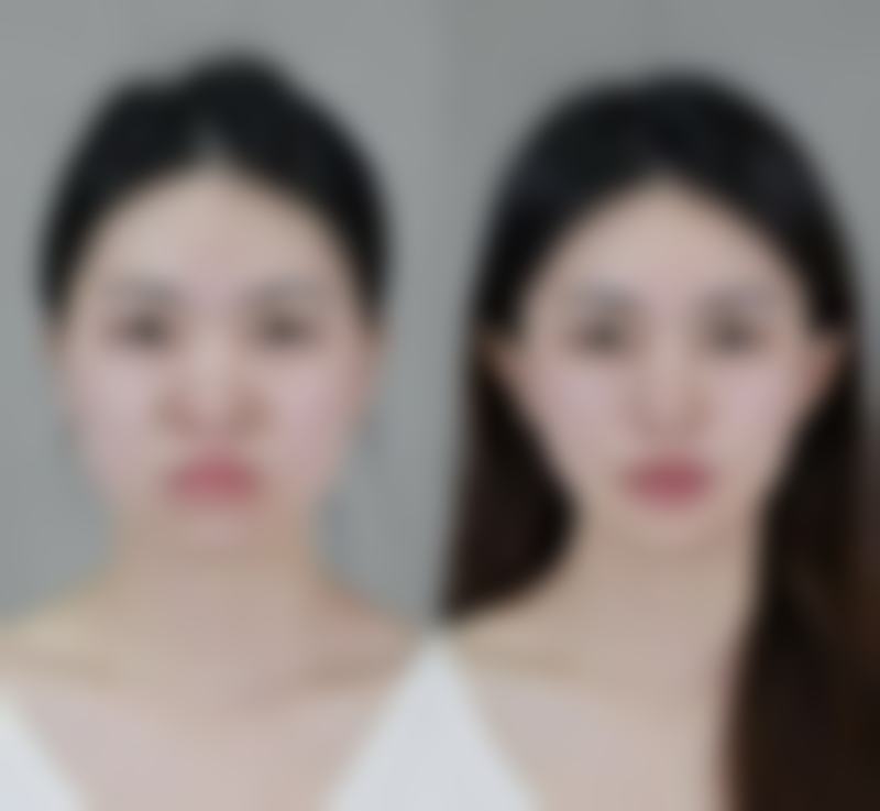 阜阳黛莱美医疗整形美容医院仪器设备