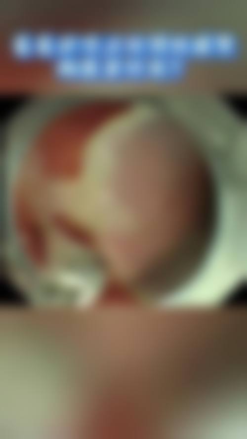 珠海美林艾瑞医疗美容门诊部真实实例
